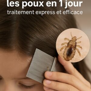 comment enlever les poux en 1 jour
